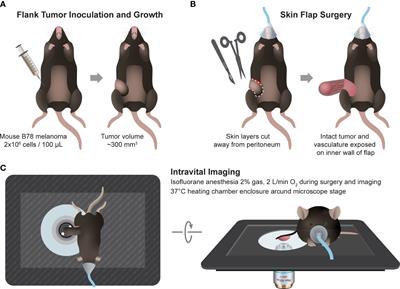 Single cell metabolic imaging of tumor and immune cells in vivo in melanoma bearing mice